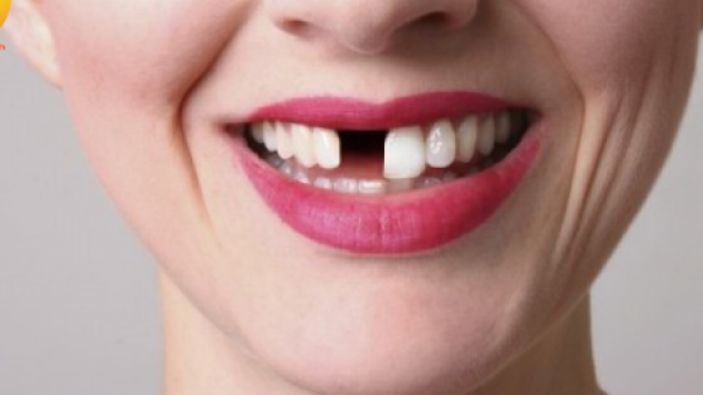 Nằm chiêm bao thấy mình bị rụng răng chảy máu có ý nghĩa gì?