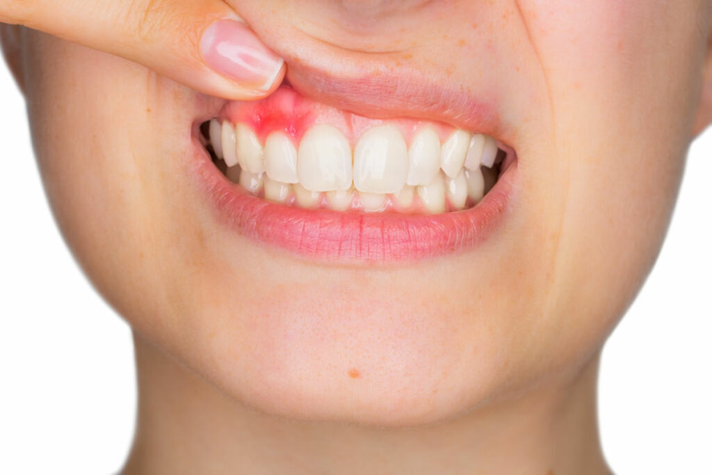 Nằm mộng thấy rụng răng chảy máu nhiều đánh số gì?